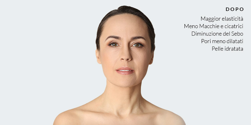 Effetto prima e dopo del trattamento AFillerAge di SkinMedic Beauty Clinic®. Dopo il trattamento la pelle del viso risulta più elastica e idratata.